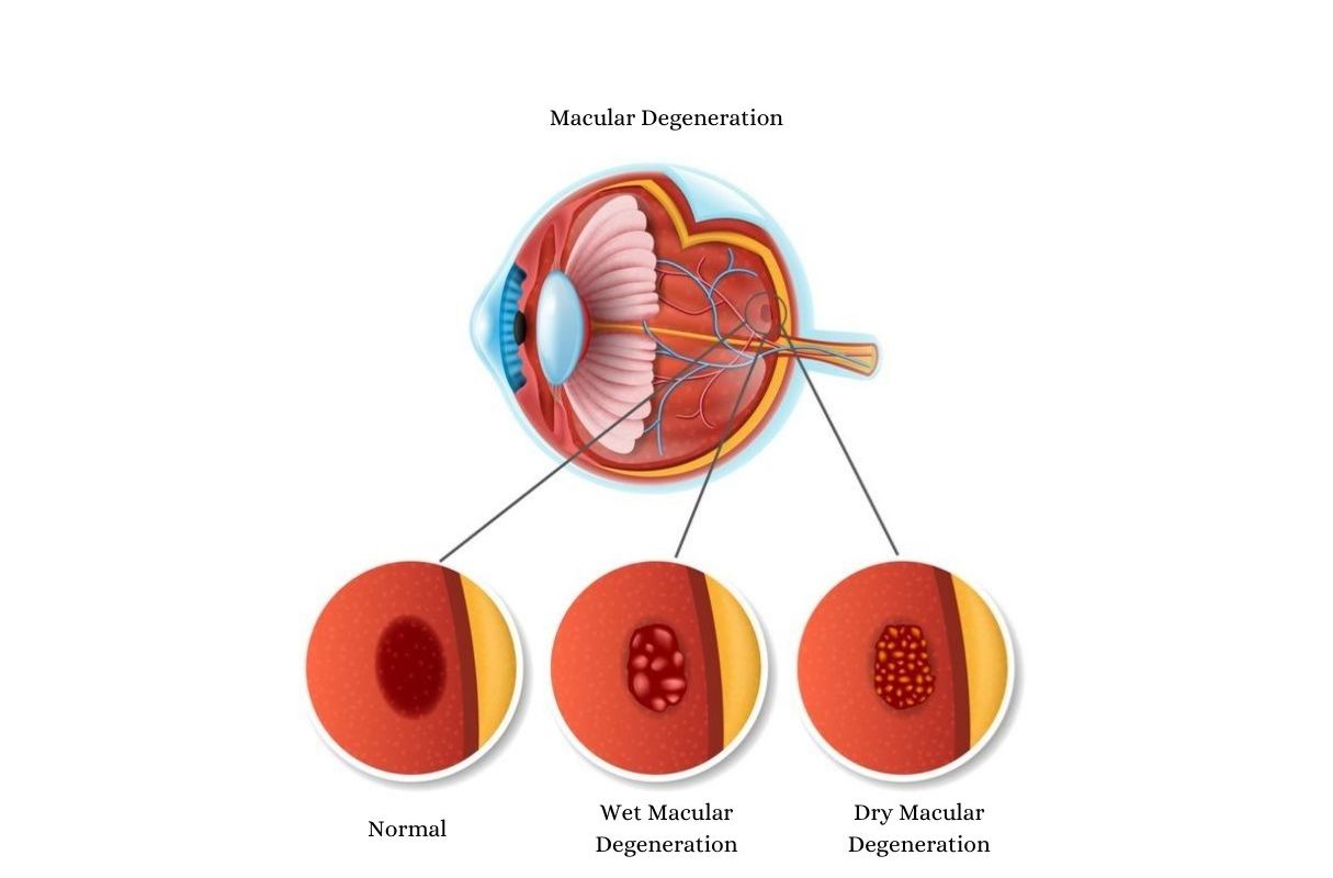 SightMD Retina Center  Garden City, New York